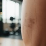 Como o atrito durante exercícios pode manchar a pele? Entenda!